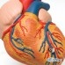 Классическая модель сердца с гипертрофией левого желудочка, 2 части