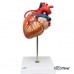 Модель сердца с шунтами, 2-кратное увеличение, 4 части
