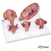 Набор из 5 моделей «Стадии беременности» 3B Scientific®