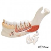 Усовершенствованная модель половины нижней челюсти с 8 больными зубами, 19 частей