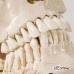 Модель черепа с зубами для обучения экстракции зуба, 4 части