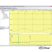 Программа и оборудование для анализа ВРС Поли-Спектр-Ритм